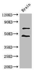 HSPC167 / CDK5RAP1 Antibody - Positive WB detected in:Mouse brain tissue;All lanes: MAL antibody at 3ug/ml;Secondary;Goat polyclonal to rabbit IgG at 1/50000 dilution;Predicted band size: 68,57,67,58,49,65 kDa;Observed band size: 68,49 kDa;