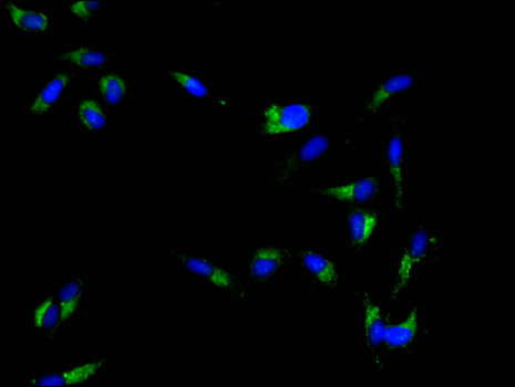 HSPC167 / CDK5RAP1 Antibody - Immunofluorescent analysis of Hela cells using MAL Antibody at a dilution of 1:100 and Alexa Fluor 488-congugated AffiniPure Goat Anti-Rabbit IgG(H+L)
