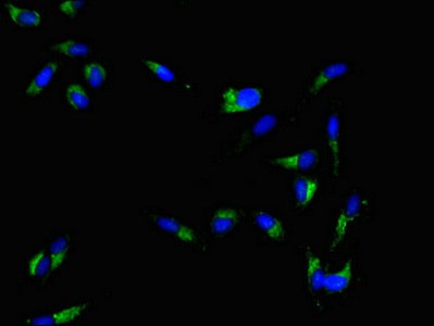 HSPC167 / CDK5RAP1 Antibody - Immunofluorescent analysis of Hela cells using MAL Antibody at dilution of 1:100 and Alexa Fluor 488-congugated AffiniPure Goat Anti-Rabbit IgG(H+L)