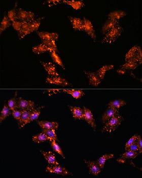 HSPC167 / CDK5RAP1 Antibody - Immunofluorescence analysis of HeLa cells using CDK5RAP1 Polyclonal Antibody at dilution of 1:100.Blue: DAPI for nuclear staining.