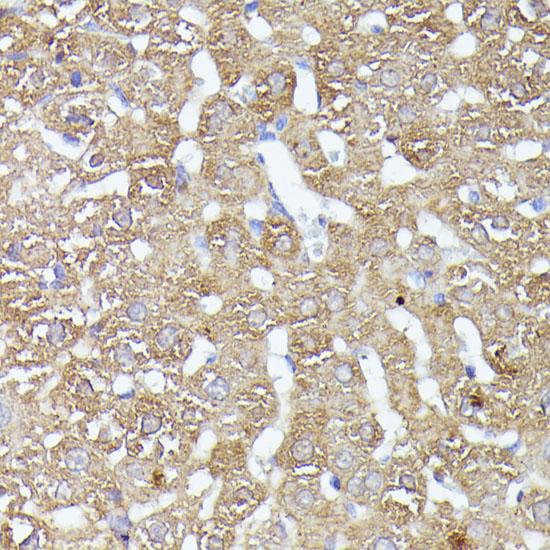 HSPC167 / CDK5RAP1 Antibody - Immunohistochemistry of paraffin-embedded Rat liver using CDK5RAP1 Polyclonal Antibody at dilution of 1:100 (40x lens).