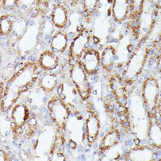 HSPC167 / CDK5RAP1 Antibody - Immunohistochemistry of paraffin-embedded Mouse kidney using CDK5RAP1 Polyclonal Antibody at dilution of 1:100 (40x lens).
