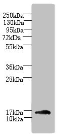 HSPC176 / TRAPPC2L Antibody - Western blot All lanes: TRAPPC2L antibody at 5µg/ml + Mouse kidney tissue Secondary Goat polyclonal to rabbit IgG at 1/10000 dilution Predicted band size: 16 kDa Observed band size: 16 kDa