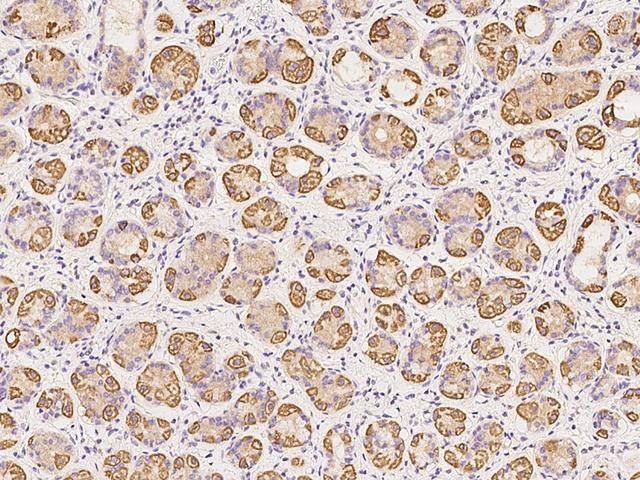 HSPC176 / TRAPPC2L Antibody - Immunochemical staining of human TRAPPC2L in human stomach with rabbit polyclonal antibody at 1:500 dilution, formalin-fixed paraffin embedded sections.