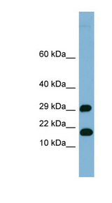 HSPC176 / TRAPPC2L Antibody - TRAPPC2L antibody Western blot of Fetal Heart lysate. This image was taken for the unconjugated form of this product. Other forms have not been tested.