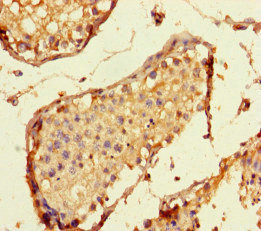 HSpc24 / SPBC24 Antibody - Immunohistochemistry of paraffin-embedded human testis tissue at dilution of 1:100