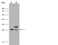 HSpc24 / SPBC24 Antibody - Anti-SPC24 rabbit polyclonal antibody at 1:500 dilution. Lane A: MOLT-4 Whole Cell Lysate. Lane B: U-251 MG Whole Cell Lysate. Lysates/proteins at 30 ug per lane. Secondary: Goat Anti-Rabbit IgG (H+L)/HRP at 1/10000 dilution. Developed using the ECL technique. Performed under reducing conditions. Predicted band size: 22 kDa. Observed band size: 26 kDa.