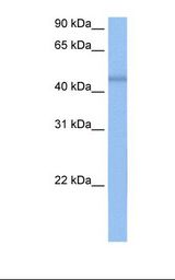 HSPC304 / C7orf64 Antibody - MCF7 cell lysate. Antibody concentration: 0.5 ug/ml. Gel concentration: 12%.  This image was taken for the unconjugated form of this product. Other forms have not been tested.