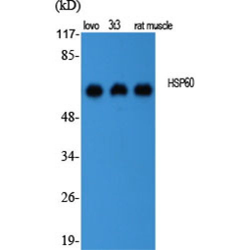 HSPD1 / HSP60 Antibody - Western blot of HSP60 antibody