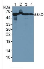 HSPD1 / HSP60 Antibody - Western Blot; Sample: Lane1: Rat Liver Tissue; Lane2: Rat Pancreas Tissue; Lane3: Human A549 Cells; Lane4: Human MCF Cells.