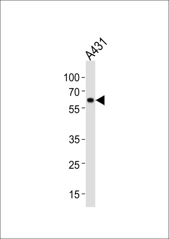 HSPD1 / HSP60 Antibody - HSPD1 Antibody western blot of A431 cell line lysates (35 ug/lane). The HSPD1 antibody detected the HSPD1 protein (arrow).