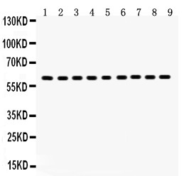 HSPD1 / HSP60 Antibody - Hsp60 antibody Western blot. All lanes: Anti Hsp60 at 0.5 ug/ml. Lane 1: Rat Kidney Tissue Lysate at 50 ug. Lane 2: Mouse Kidney Tissue Lysate at 50 ug. Lane 3: HEPA Whole Cell Lysate at 40 ug. Lane 4: NRK Whole Cell Lysate at 40 ug. Lane 5: PC-12 Whole Cell Lysate at 40 ug. Lane 6: SW620 Whole Cell Lysate at 40 ug. Lane 7: A549 Whole Cell Lysate at 40 ug. Lane 8: A431 Whole Cell Lysate at 40 ug. Lane 9: HELA Whole Cell Lysate at 40 ug. Predicted band size: 60 kD. Observed band size: 60 kD.
