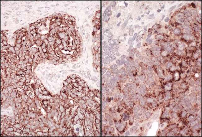 HSPD1 / HSP60 Antibody - Detection of Human and Mouse HSP60 by Immunohistochemistry. Sample: FFPE section of human ovarian carcinoma (left) and mouse teratoma (right). Antibody: Affinity purified rabbit anti-HSP60 used at a dilution of 1:200 (1 ug/ml). Detection: Vector Laboratories ImmPACT NovaRED Peroxidase Substrate.