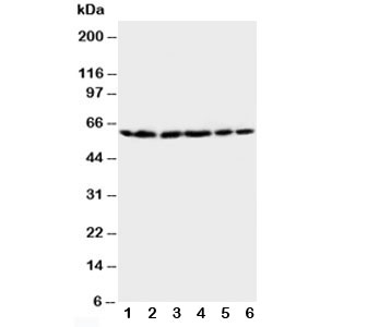 HSPD1 / HSP60 Antibody - Western blot testing of HSP60 antibody and Lane 1: rat brain; 2: rat liver; 3: CEM; 4: HeLa; 5: SMMC-7721; 6: COLO320 cell lysate