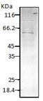 HSPD1 / HSP60 Antibody - Western blot analysis of PfHsp60 using a 1:1000 dilution of HSPD1 / HSP60 antibody.  This image was taken for the unconjugated form of this product. Other forms have not been tested.