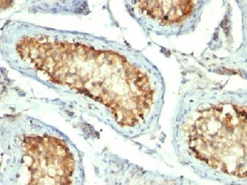 HSPD1 / HSP60 Antibody - IHC testing of FFPE human testicular carcinoma with HSP60 antibody (clone GROEL/730).  This image was taken for the unmodified form of this product. Other forms have not been tested.