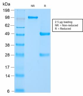 HSPD1 / HSP60 Antibody - SDS-PAGE Analysis of Purified HSP60 Rabbit Recombinant Monoclonal Antibody (HSPD1/2206R). Confirmation of Purity and Integrity of Antibody.