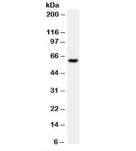 HSPD1 / HSP60 Antibody - Western blot testing of HeLa cell lysate with HSP60 antibody (clone LK1). This image was taken for the unmodified form of this product. Other forms have not been tested.