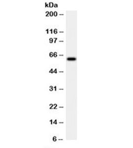HSPD1 / HSP60 Antibody - Western blot testing of HeLa cell lysate with HSP60 antibody (clone LK2). This image was taken for the unmodified form of this product. Other forms have not been tested.