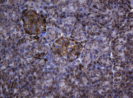 HSPD1 / HSP60 Antibody - IHC of paraffin-embedded Human pancreas tissue using anti-HSPD1 mouse monoclonal antibody.