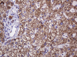 HSPD1 / HSP60 Antibody - IHC of paraffin-embedded Human liver tissue using anti-HSPD1 mouse monoclonal antibody.