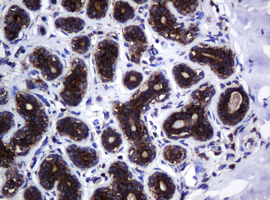 HSPD1 / HSP60 Antibody - IHC of paraffin-embedded Human breast tissue using anti-HSPD1 mouse monoclonal antibody.