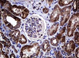 HSPD1 / HSP60 Antibody - IHC of paraffin-embedded Human Kidney tissue using anti-HSPD1 mouse monoclonal antibody.