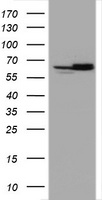 HSPD1 / HSP60 Antibody - HEK293T cells were transfected with the pCMV6-ENTRY control (Left lane) or pCMV6-ENTRY HSPD1 (Right lane) cDNA for 48 hrs and lysed. Equivalent amounts of cell lysates (5 ug per lane) were separated by SDS-PAGE and immunoblotted with anti-HSPD1.