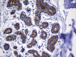 HSPD1 / HSP60 Antibody - IHC of paraffin-embedded Human breast tissue using anti-HSPD1 mouse monoclonal antibody.