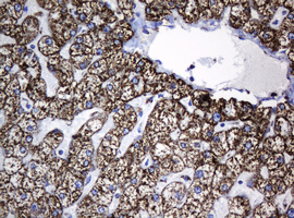 HSPD1 / HSP60 Antibody - IHC of paraffin-embedded Human liver tissue using anti-HSPD1 mouse monoclonal antibody.