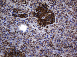 HSPD1 / HSP60 Antibody - IHC of paraffin-embedded Human pancreas tissue using anti-HSPD1 mouse monoclonal antibody.