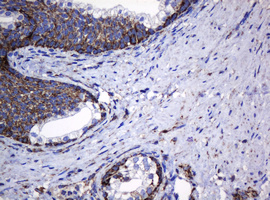 HSPD1 / HSP60 Antibody - IHC of paraffin-embedded Human prostate tissue using anti-HSPD1 mouse monoclonal antibody.