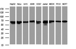 HSPD1 / HSP60 Antibody - Western blot of extracts (35 ug) from 9 different cell lines by using anti-HSPD1 monoclonal antibody (HepG2: human; HeLa: human; SVT2: mouse; A549: human; COS7: monkey; Jurkat: human; MDCK: canine; PC12: rat; MCF7: human).