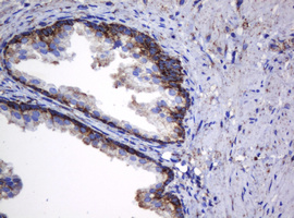 HSPD1 / HSP60 Antibody - IHC of paraffin-embedded Human prostate tissue using anti-HSPD1 mouse monoclonal antibody.