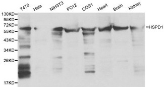 HSPD1 / HSP60 Antibody - Western blot of HSPD1 pAb in extracts from T470, Hela, NIH3T3, PC12, COS1 cells and mouse heart, brain, kidney tissues.