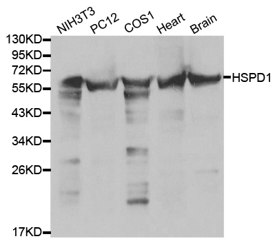 HSPD1 / HSP60 Antibody - Western blot analysis of extracts of various cell lines.