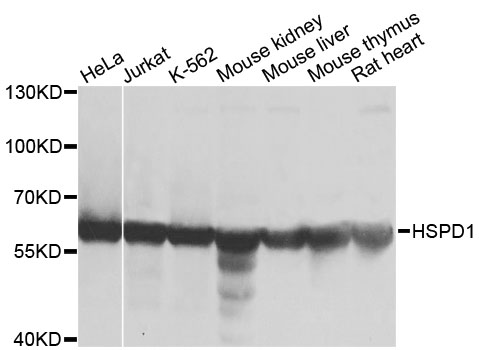 HSPD1 / HSP60 Antibody - Western blot analysis of extracts of various cell lines, using HSPD1 antibody at 1:1000 dilution. The secondary antibody used was an HRP Goat Anti-Rabbit IgG (H+L) at 1:10000 dilution. Lysates were loaded 25ug per lane and 3% nonfat dry milk in TBST was used for blocking. An ECL Kit was used for detection and the exposure time was 10s.