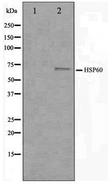 HSPD1 / HSP60 Antibody - Western blot of COLO205 cell lysate using HSP60 Antibody