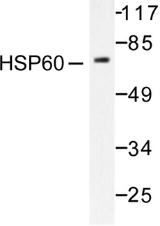 HSPD1 / HSP60 Antibody - Western blot of HSP60/HSPD1 (T547) pAb in extracts from COLO205 cells.