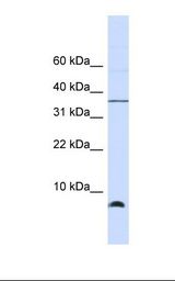 HSPE1 / HSP10 / Chaperonin 10 Antibody - Fetal brain lysate. Antibody concentration: 1.0 ug/ml. Gel concentration: 10-20%.  This image was taken for the unconjugated form of this product. Other forms have not been tested.