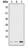 HSPE1 / HSP10 / Chaperonin 10 Antibody - Western blot analysis of HSPE1 expression in HeLa (A); NIH3T3 (B); PC12 (C) whole cell lysates.