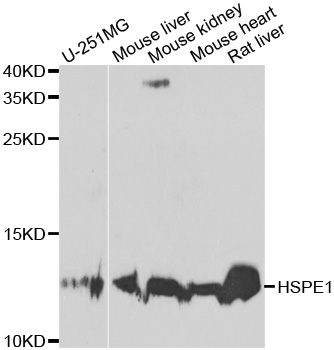 HSPE1 / HSP10 / Chaperonin 10 Antibody - Western blot analysis of extracts of various cell lines.