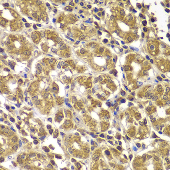 HSPE1 / HSP10 / Chaperonin 10 Antibody - Immunohistochemistry of paraffin-embedded human gastric tissue.