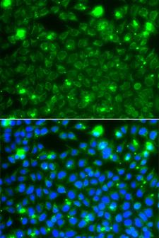 HSPE1 / HSP10 / Chaperonin 10 Antibody - Immunofluorescence analysis of A549 cells.