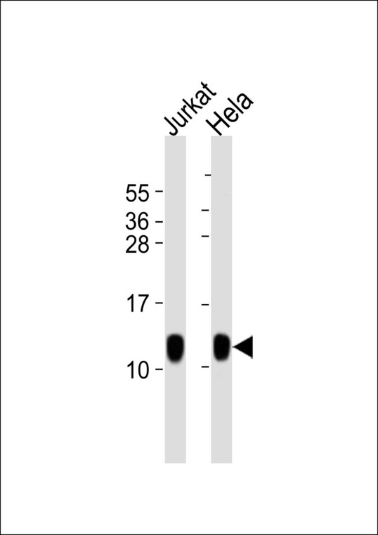 HSPE1 / HSP10 / Chaperonin 10 Antibody - All lanes : Anti-HSPE1 Antibody at 1:1000 dilution Lane 1: Jurkat whole cell lysates Lane 2: HeLa whole cell lysates Lysates/proteins at 20 ug per lane. Secondary Goat Anti-Rabbit IgG, (H+L),Peroxidase conjugated at 1/10000 dilution Predicted band size : 11 kDa Blocking/Dilution buffer: 5% NFDM/TBST.