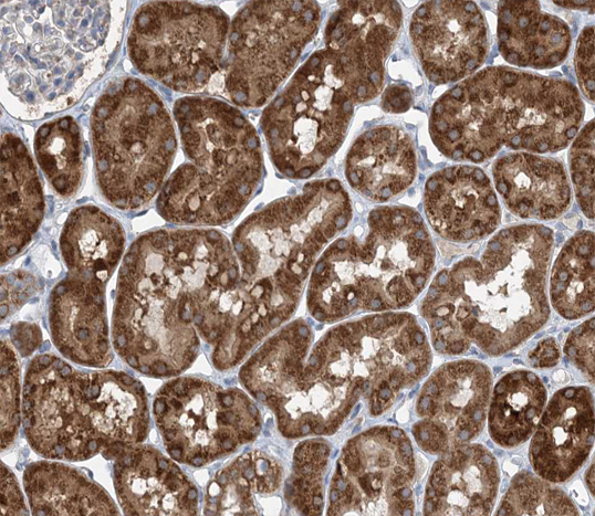 HSPE1 / HSP10 / Chaperonin 10 Antibody - 1:100 staining human kidney tissue by IHC-P. The tissue was formaldehyde fixed and a heat mediated antigen retrieval step in citrate buffer was performed. The tissue was then blocked and incubated with the antibody for 1.5 hours at 22°C. An HRP conjugated goat anti-rabbit antibody was used as the secondary.