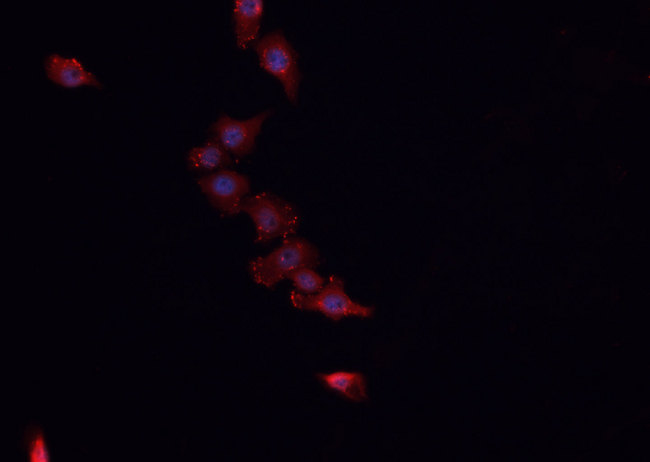 HSPE1 / HSP10 / Chaperonin 10 Antibody - Staining HeLa cells by IF/ICC. The samples were fixed with PFA and permeabilized in 0.1% Triton X-100, then blocked in 10% serum for 45 min at 25°C. The primary antibody was diluted at 1:200 and incubated with the sample for 1 hour at 37°C. An Alexa Fluor 594 conjugated goat anti-rabbit IgG (H+L) antibody, diluted at 1/600, was used as secondary antibody.