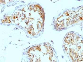 HSPG2 / Perlecan Antibody - Formalin-fixed, paraffin-embedded human testicular carcinoma stained with Perlecan antibody (A7L6).  This image was taken for the unmodified form of this product. Other forms have not been tested.