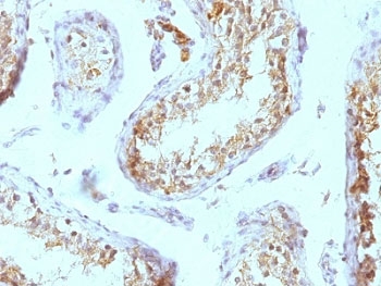 HSPG2 / Perlecan Antibody - Formalin-fixed, paraffin-embedded human testicular carcinoma stained with anti-Perlecan antibody (SPM255).  This image was taken for the unmodified form of this product. Other forms have not been tested.