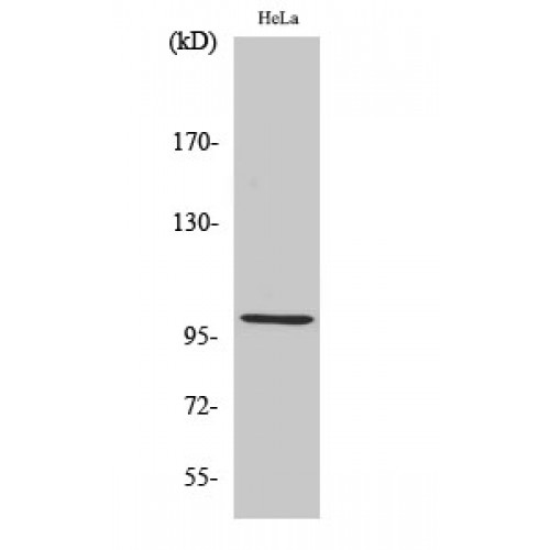 HSPH1 / HSP105 Antibody - Western blot of HSP105 antibody